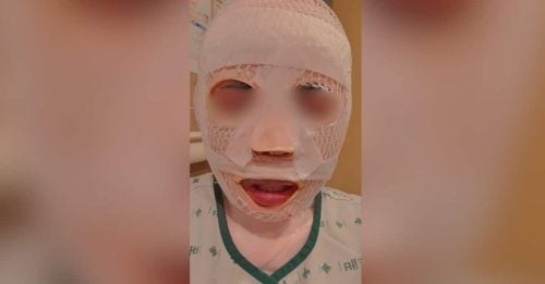 怕她一去不回 他竟滚水烫她脸