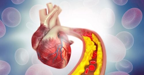 杀死血管的凶手 医点名奶油比猪油更“伤心”